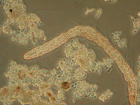 Aelosoma 1037