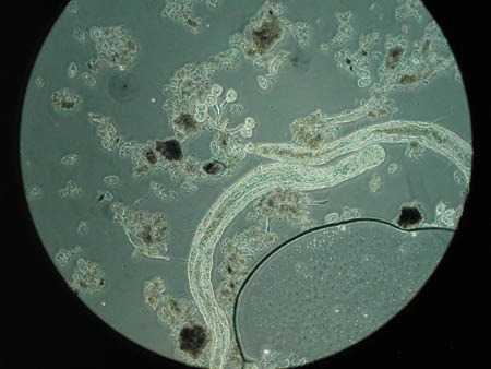 Aelosoma 4772