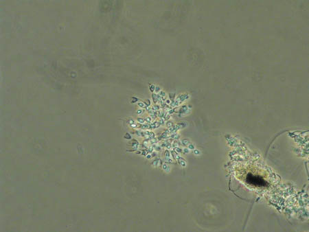 Becherflagellaten 1271