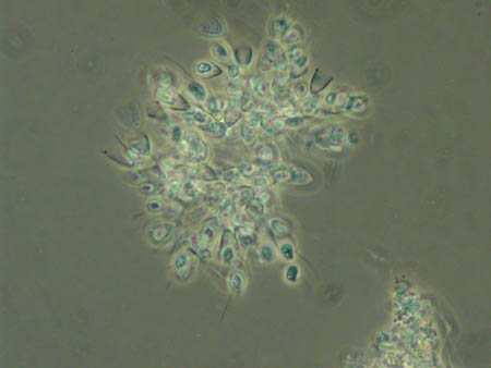 Becherflagellaten 1272