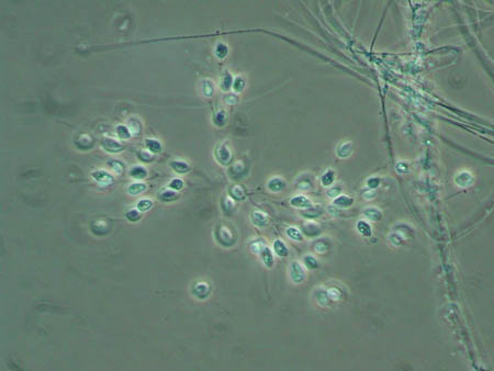 Becherflagellaten 5015