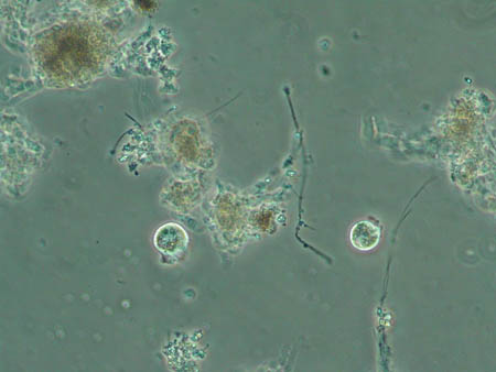 Chlamydophrys 3596