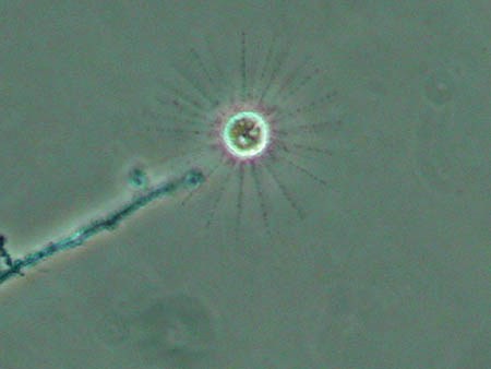 Heliozoa 2966