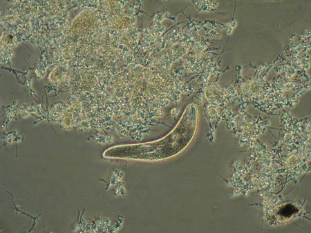 Spirostomum 1410